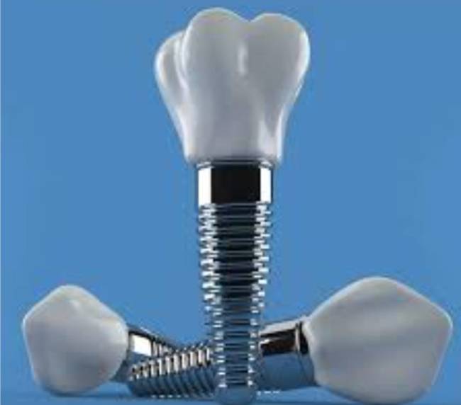 implant dentar ieftin